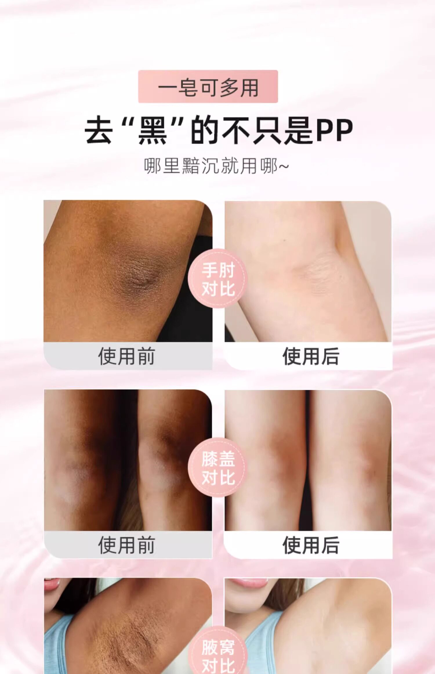赵露思推荐~大腿内侧不黑了全身白pp皂 天生黄皮肤也能白买2 发3