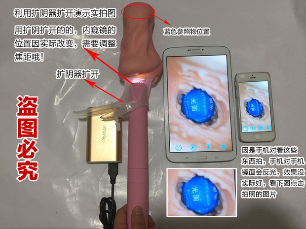 超高清医用usb内窥镜手机宫颈阴道镜妇科自检美容用品