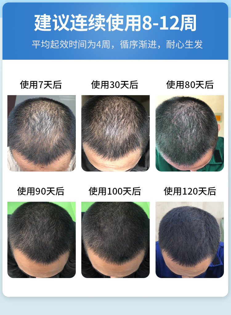 米诺地尔酊价格,说明书,功效,作用_160大药房