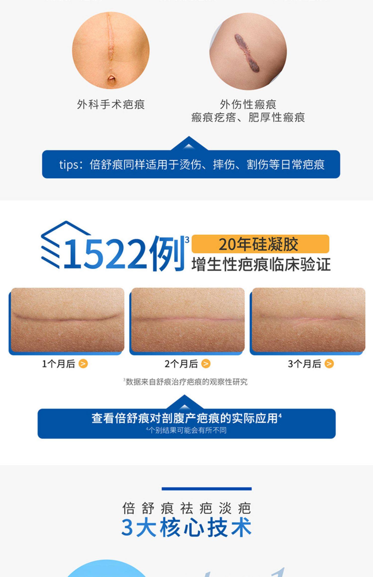 倍舒痕dermatix硅凝胶舒痕祛疤膏美国术后剖腹产双眼皮疤痕修复