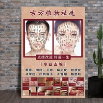 Dot Mole Propaganda Photos of Men and Women Facial Mole Plot to Mole Pictures Beauty Salon Decoration Painting Facial Open Waypoint Nevus to dispel mole