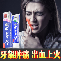 Toothache Toothache Special toothpaste Tooth Pain Wisdom Tooth upper fire Toothbrushing Bleeding Traditional Chinese Medicine Clear heat to relieve pain S