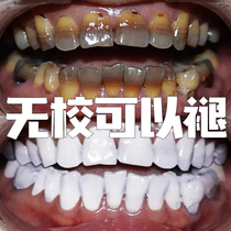 Small soda to go to dental smoke stains toothpaste to remove tea stains yellow tooth gram Stones Mouth Smelly cleaning Mens special S