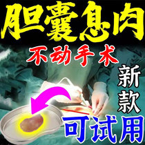 Unsurgery ) gallbladder cholesterol paste to relieve the abdominal swelling and discomfort