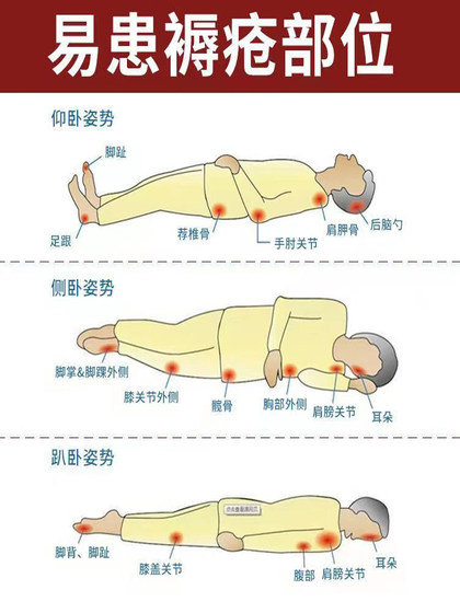 침대 선수 크림은 상처 치유와 신속하게 딱지를 촉진하기 위해 외부에서 사용되는 압력 상처와 다리를 가진 노인들을위한 휘발성 크림을 제거합니다. 침대 선수 크림은 상처 치유와 신속하게 딱지를 촉진하기 위해 외부에서 사용되는 압력 상처와 다리를 가진 노인들을위한 휘발성 크림을 제거합니다.