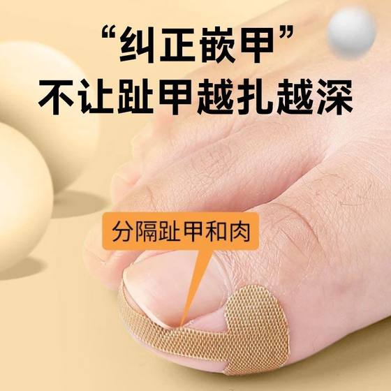 접착제가없는 손톱 패치 네일 삽입 및 손톱 발톱의 수정 도구를 점차적으로 수정하기위한 패치 하나 접착제가없는 손톱 패치 네일 삽입 및 손톱 발톱의 수정 도구를 점차적으로 수정하기위한 패치 하나