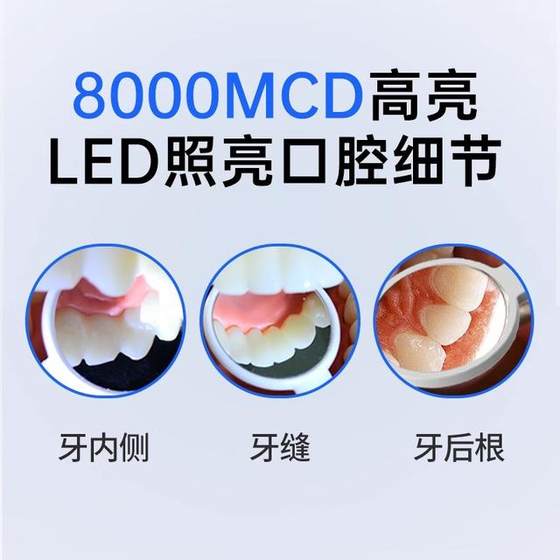 충전 LED 구강 검사 거울 치과 내시경 치과 용 거울 치과 용 거울 가정 치과 도구 고화질 방지 충전 LED 구강 검사 거울 치과 내시경 치과 용 거울 치과 용 거울 가정 치과 도구 고화질 방지