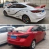 Sedan GM phía sau spoiler sửa đổi cánh phía sau GT xe thể thao cánh với khung cánh cố định phong trào cánh máy bay