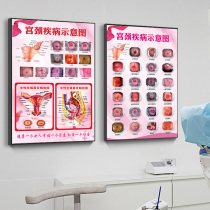 Medical Human Reproductive Organs Structure Anatomy Diagram Female Reproductive System Anatomy Diagram Health Knowledge Promotion