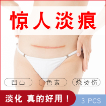 Silicone gel scar patch caesarean section surgery to remove scar silicone gel hyperplasia protrusion repair children knife edge patch