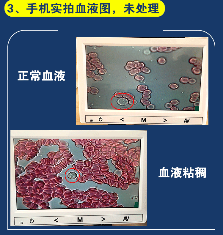 高清螨虫精子排卵血液检测 美容显微镜 生物电子显微镜