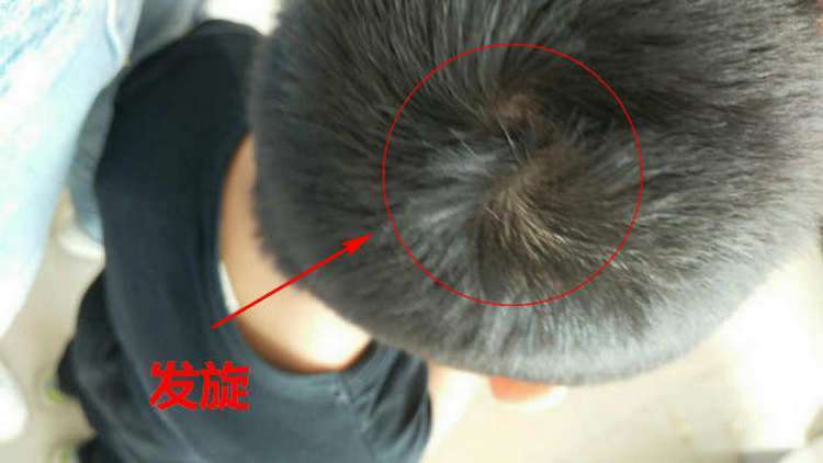 宝宝头上有两个旋,真的代表更聪明?