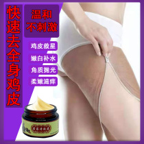 Goosebumps Hair Follicles Keratin KeratinOus Goosebumps Skin Savior Antipruritic Cream Skin Itching Body Lotion GS