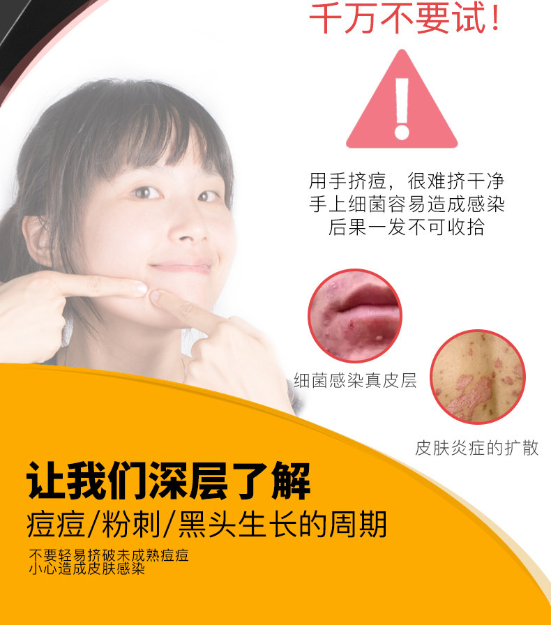 去粉刺针黑头夹屈臣氏脸部祛痘神器青春痘日本美容挤痘痘工具套装_7折