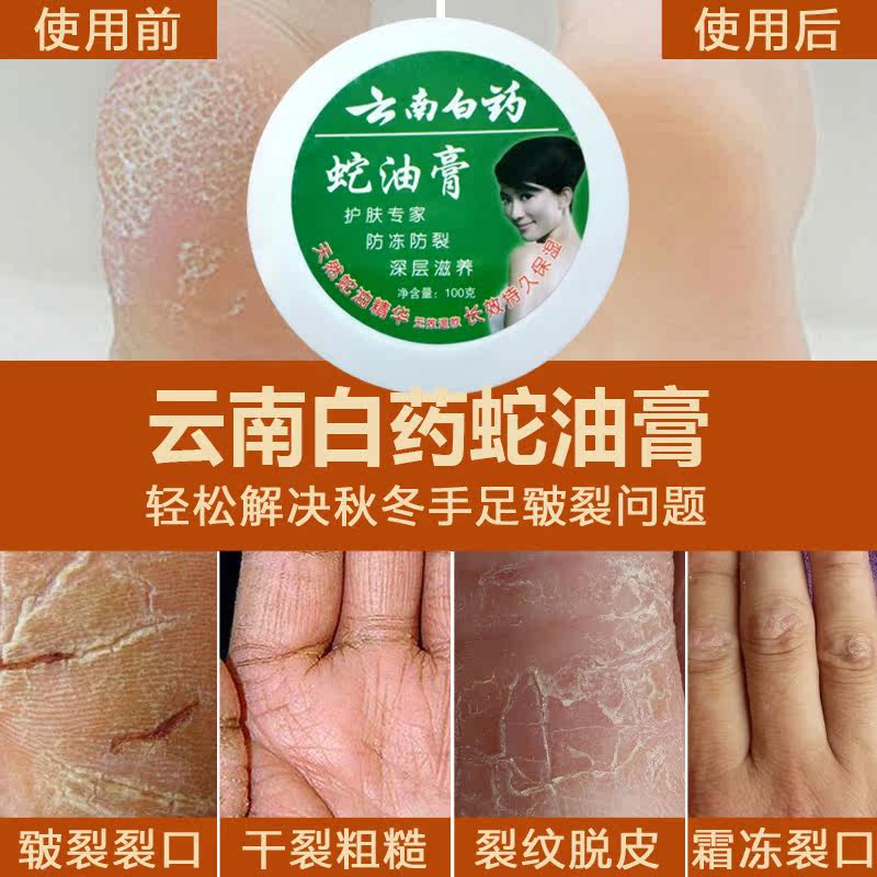 云南白药蛇油膏防裂脱皮手脚痒水泡神奇抗干裂手足裂口男女防冻