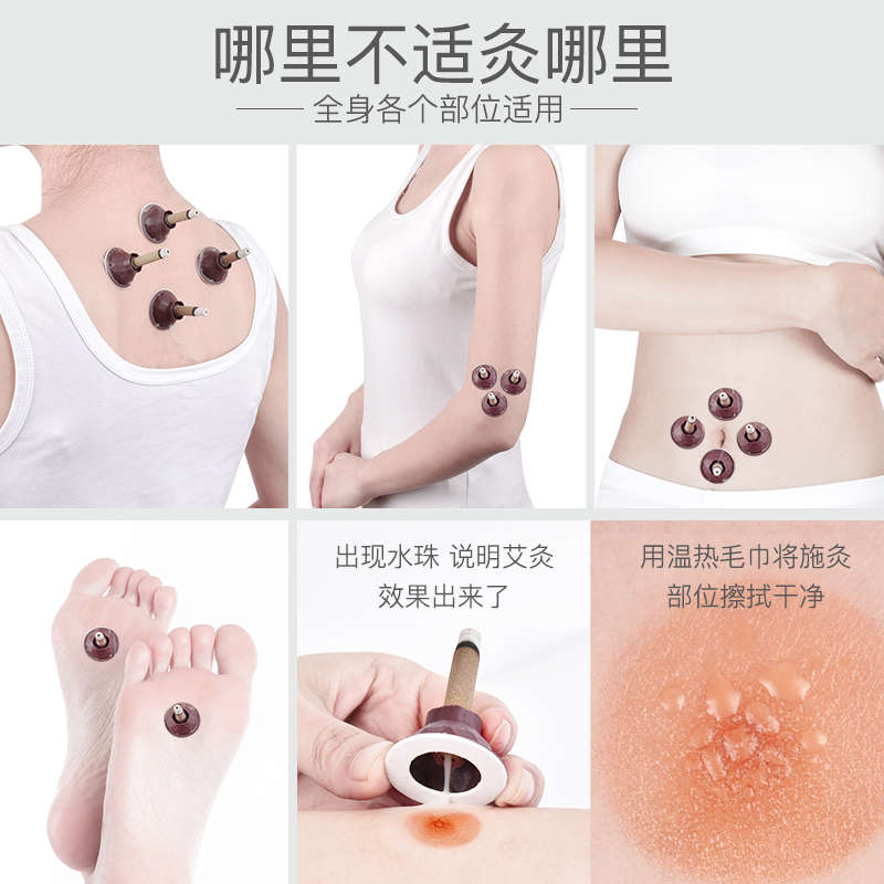 deep moxa thi moxa stis home moxa stis genuine 40 capsules moxibustion stis moxa moxa moxibustion box