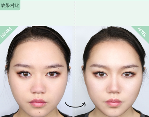 高光修容小意思,360无死角小脸修容术