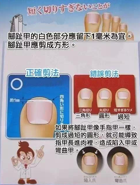 2,正确的修剪趾甲的方法是呈圆弧状推进剪,然后用指甲刀上的挫刀磨光