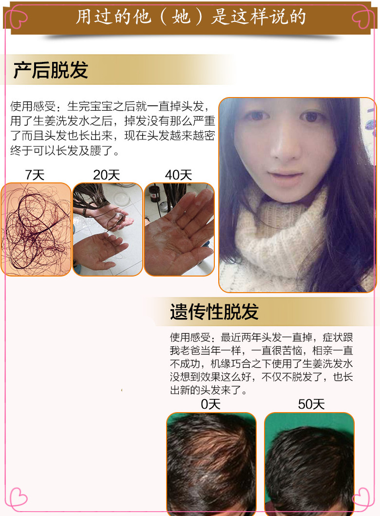 【长发神器】头发长得快变密3-5倍自然生长速