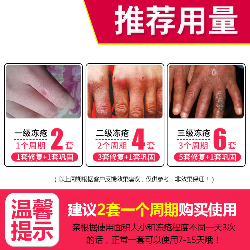 迪王冻疮膏特效止痒 防冻防裂去手脚防冻膏冻手膏冻伤膏护手霜产品展示图4