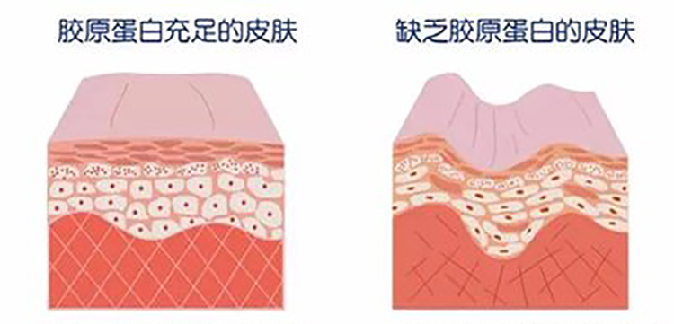 干皮抗皱三步走，轻松维持冻龄肌33