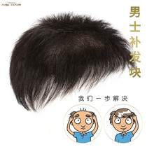 Weaving hair replacement mens forehead replacement invisible traceless real hair hair hairline balding patch patch top wig