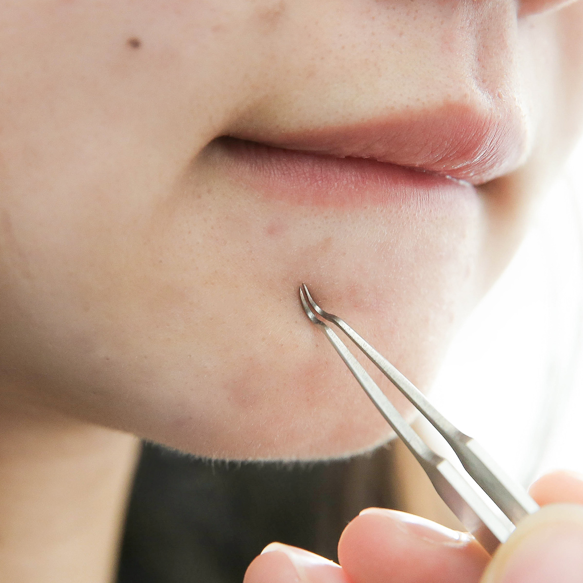 拔黑头粉刺 镊子 粉刺针黑头针暗疮针挑去脂肪粒细胞夹挤痘痘工具