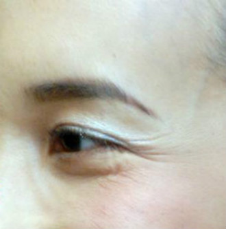 不想鱼尾纹显老!就别傻傻分不清细纹干纹