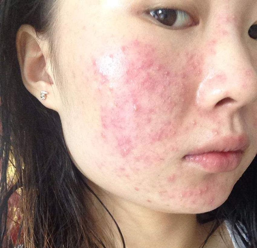 换了这几样就解决了!