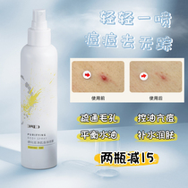Spray yourself without asking for people ~ Demarun net muscle spray 200ml back body control oil and acne refreshing body