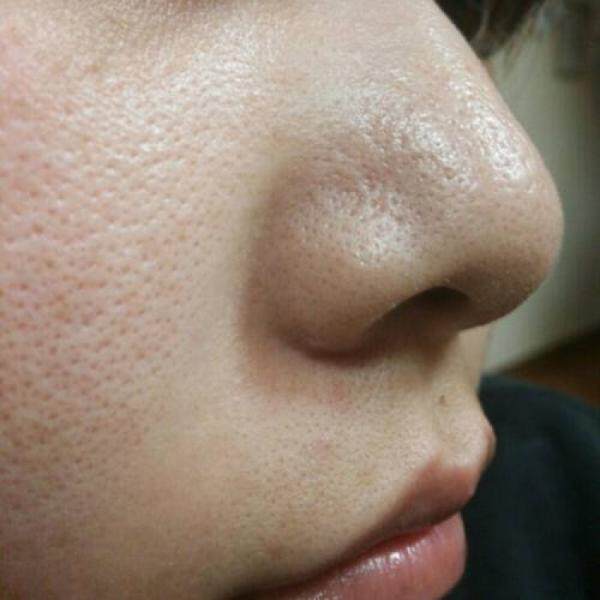 怎样遮大毛孔?最简单粗暴的方法告诉你!