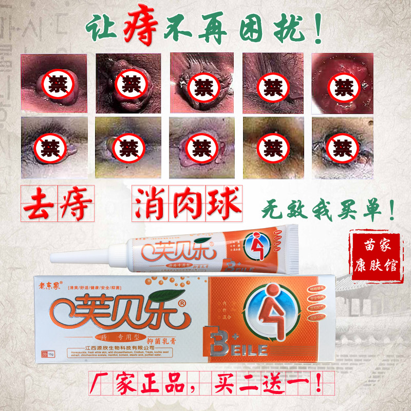痔痔膏特效消肉球正品成人男女性通用产后混合痣痔根断去肉球止痒_7折