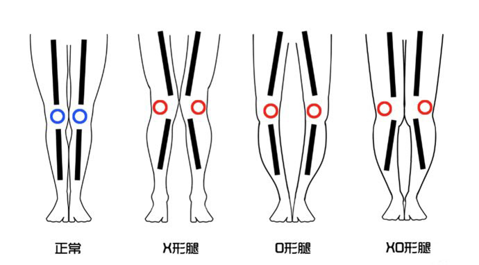 腿型不直穿衣不好看？1条裤子帮你搞定5