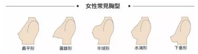扁平型:乳房底部大,但隆起不高.建议选择1/2罩杯或者是有插片的文胸.