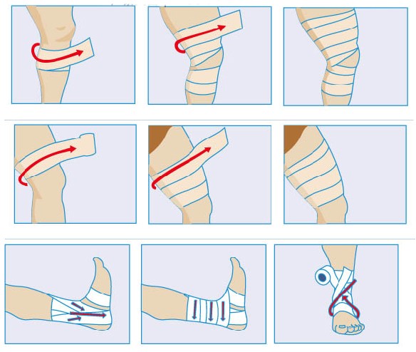 医用自粘弹力绷带运动扭伤防护术后包扎固定瘦身吸脂烧伤疤痕加压