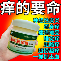 Governance (itching is terrible) pruritus cream skin itching antipruritic antibacterial male and female private parts anus wet itching