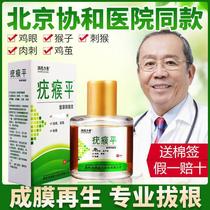 Wart flat point to go to the monkeys medicine meat pimples to remove the scabbard warts to remove the artifact fish scales mole foot thorn monkeys