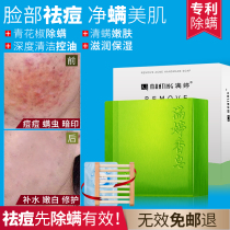 Manting green pepper mites deodorant soap soap facial body removal mite face cleaning handmade soap