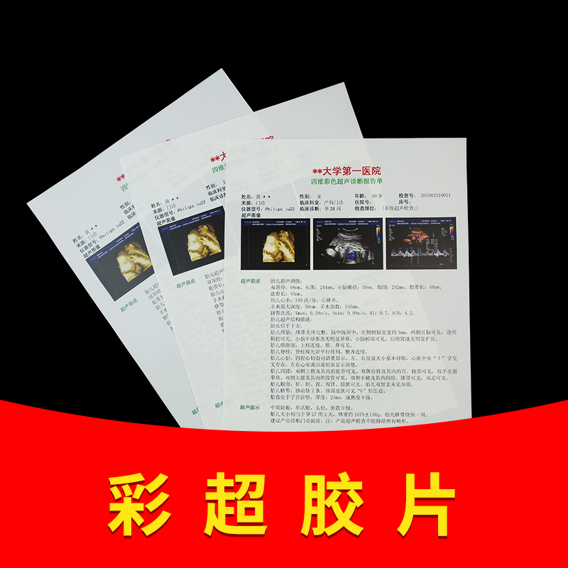 Hospital color superfilm printing paper B super gastroscope inkjet porcelain white translucent laser dry film paper