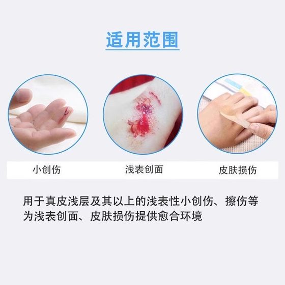 반창고 방수 방수 통기성 반창고 의료 상처 패치 100 정이 작은 상처 의학적 보이지 않는 반창고 방수 방수 통기성 반창고 의료 상처 패치 100 정이 작은 상처 의학적 보이지 않는