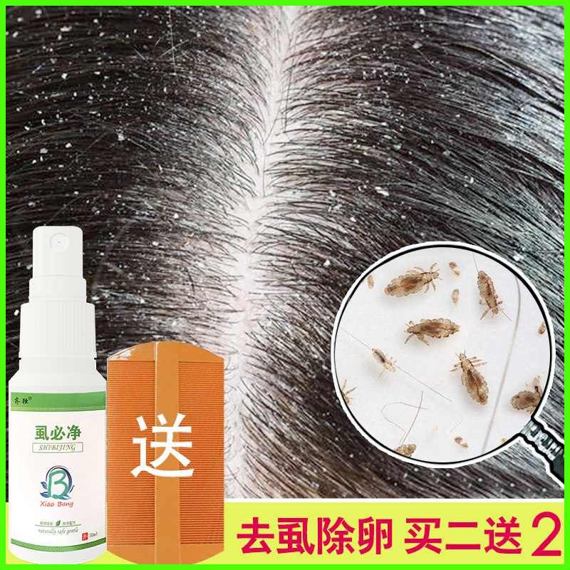 除虱子药人用儿童头发小女孩头上长虱子去头虱卵跳蚤百部喷雾神器