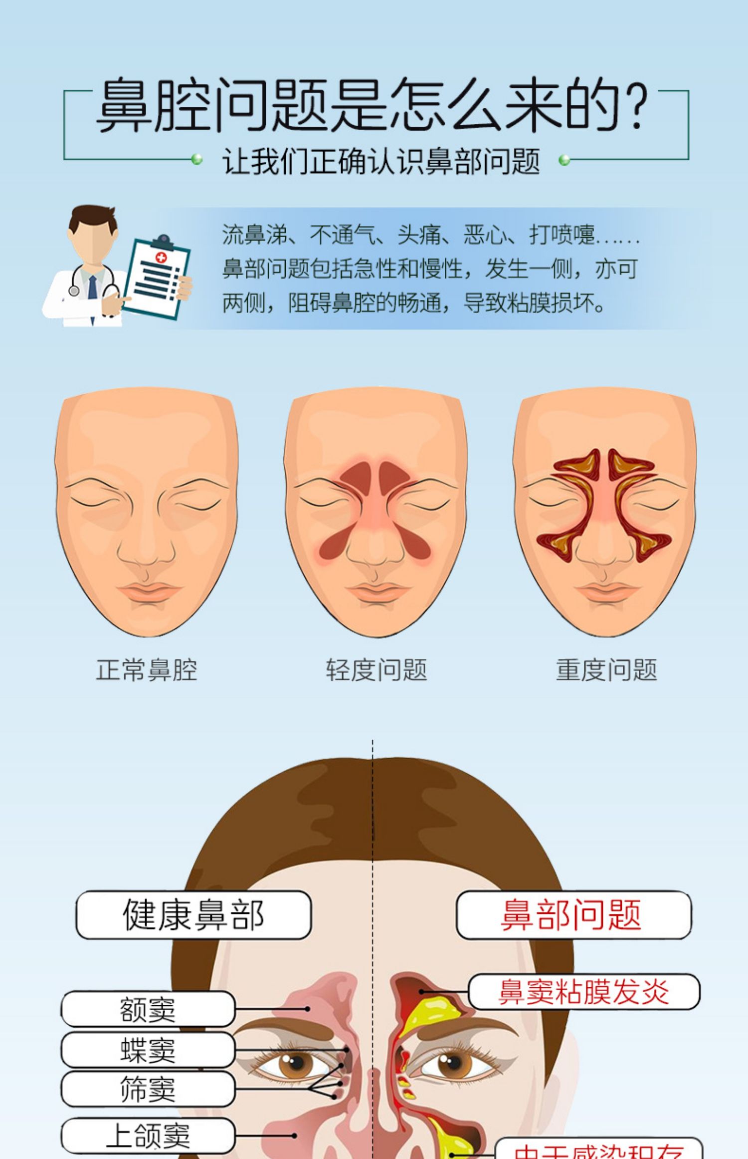 鼻炎喷雾鼻塞喷剂过敏性鼻炎神器治鼻腔痒