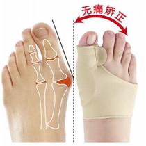 Big foot thumb valgus toe valgus Big foot bone foot valgus Hallux valgus corrector with day and night use