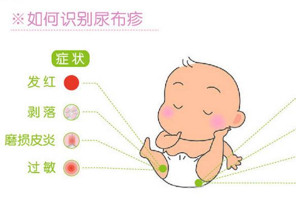 亲贝辣妈划重点:其实不是所以的纸尿裤都会让宝宝患上尿布疹的,只是