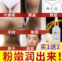 Elbow melanin Full body whitening precipitation fading Joint Elbow Knee Elbow finger Non-black non-artifact