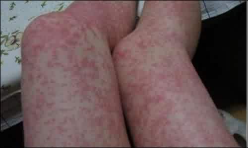 据了解,新衣服上大多残留着防皱处理的化学药品——甲醛.