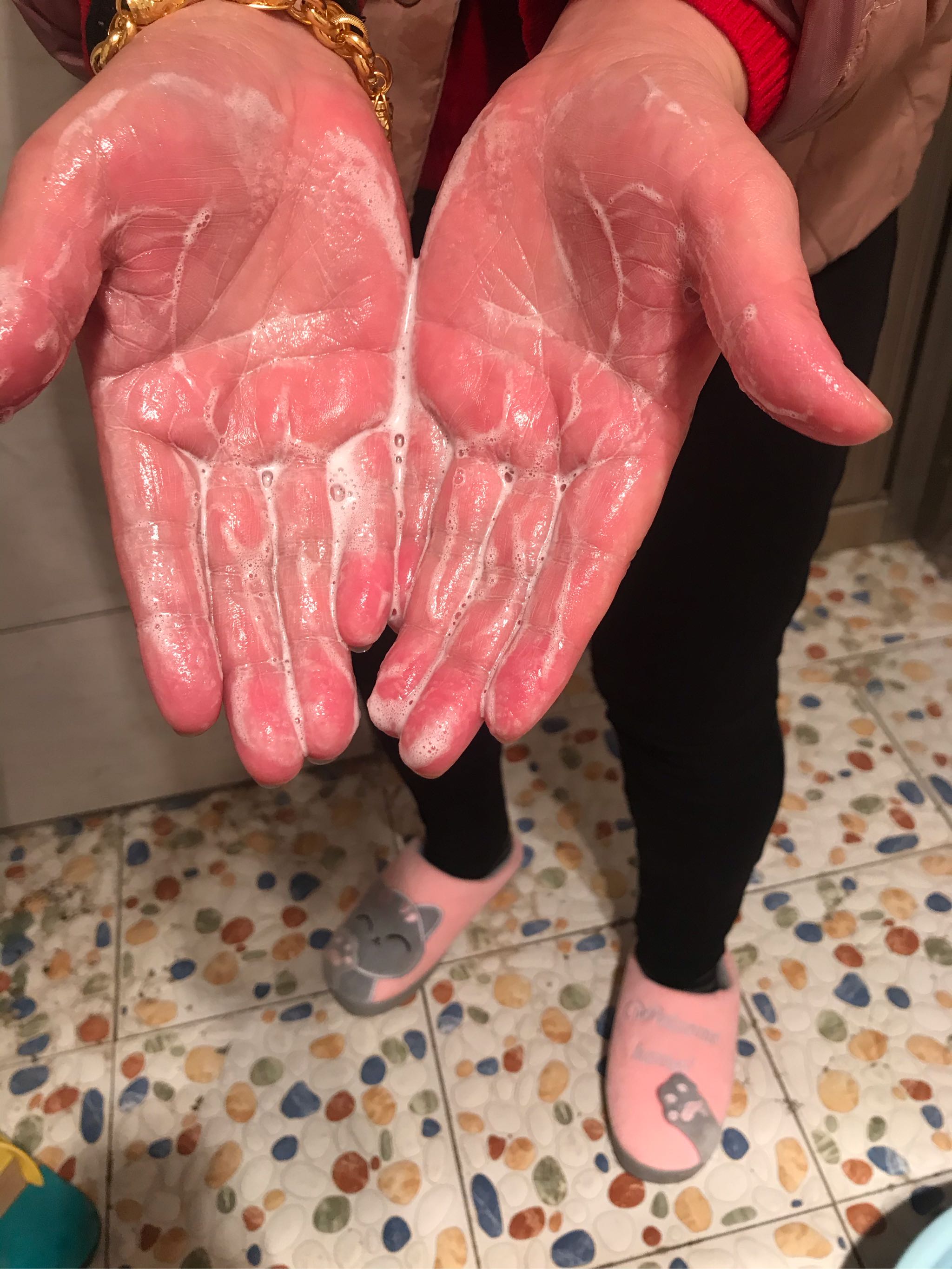 桃花精华洁面慕斯洗卸二合一效果怎么样,真的好用吗?使用两周真实效果,第11张 桃花精华洁面慕斯洗卸二合一效果怎么样,真的好用吗?使用两周真实效果,第11张