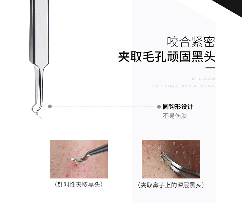 粉刺夹细胞夹镊子祛痘挤痘痘工具去脂肪粒拔粉刺针暗疮黑头针套装