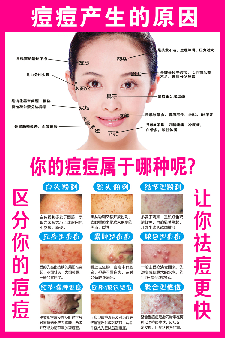 青春痘产生的原因痘痘的类型痤疮浓胞祛痘美容