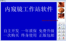 Endoscopic workstation software endoscopic colonoscopy bronchoscopy laparoscope text system genuine dog version